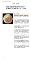 Ch.3 Diseases of the TM and Middle Ear pp.54-88.pdf